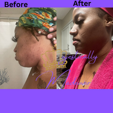 Load image into Gallery viewer, Bar Hyperpigmentation