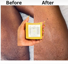 Load image into Gallery viewer, Bar Hyperpigmentation