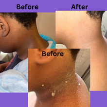 Cargar imagen en el visor de la galería, Scrub Hyperpigmentation